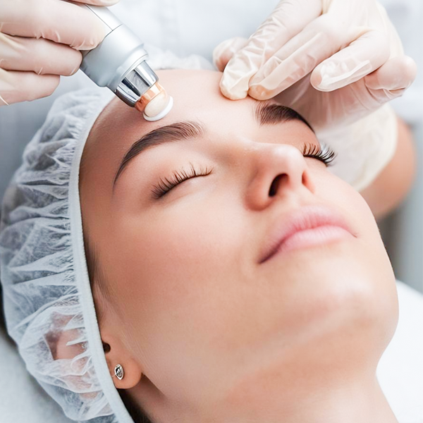 Microagulhamento com PDRN